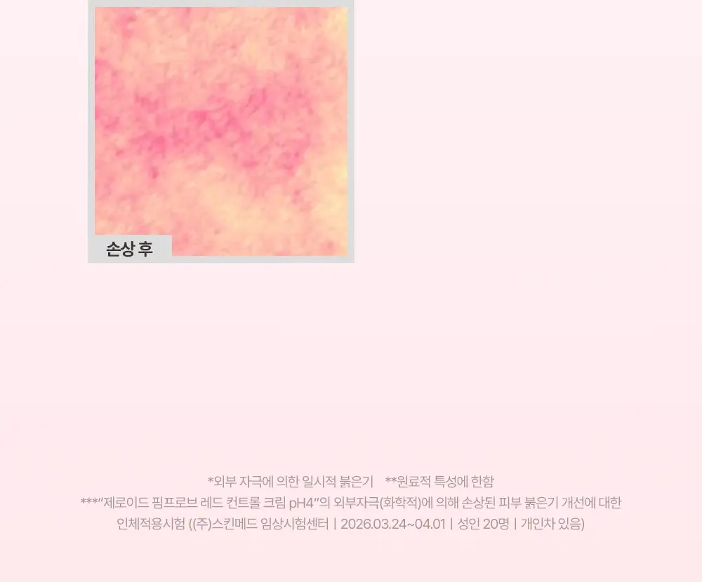 [트러블 피부 추천/약산성 장벽 케어] 제로이드 핌프로브 레드 컨트롤 크림 pH4 80ml 상세페이지 28